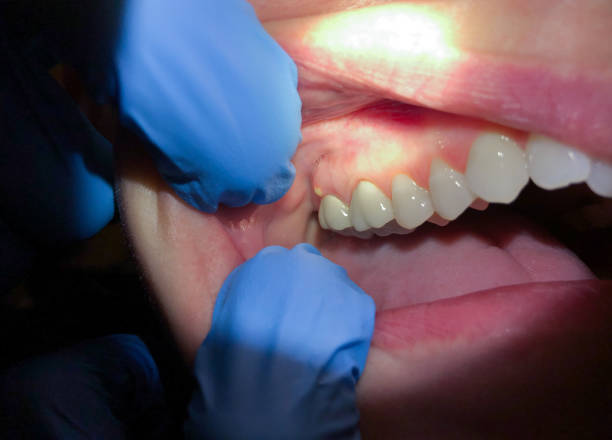 Best Root Canal Emergency Dentist  in Bartlesville, OK